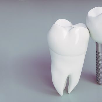Hardness Testing of Dental Composites